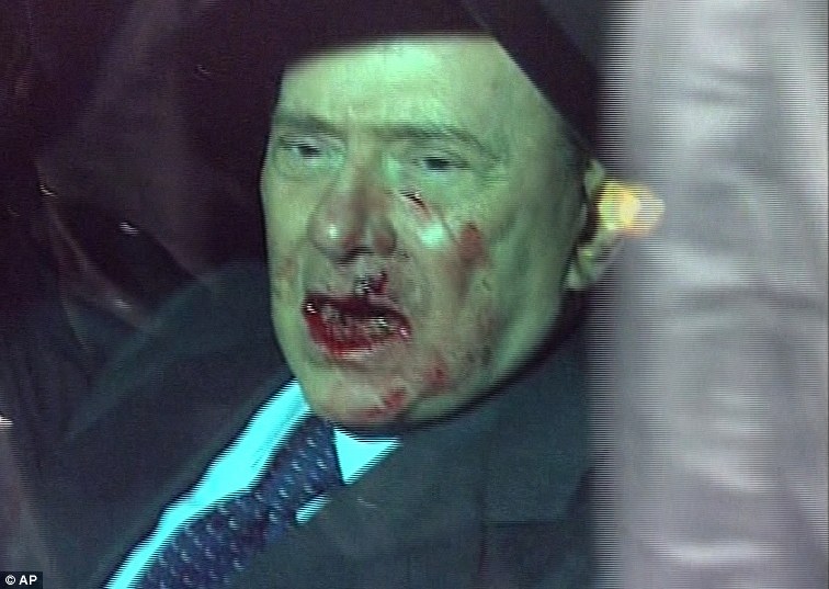 broken nose before and after. Berlusconi#39;s Nose Broken